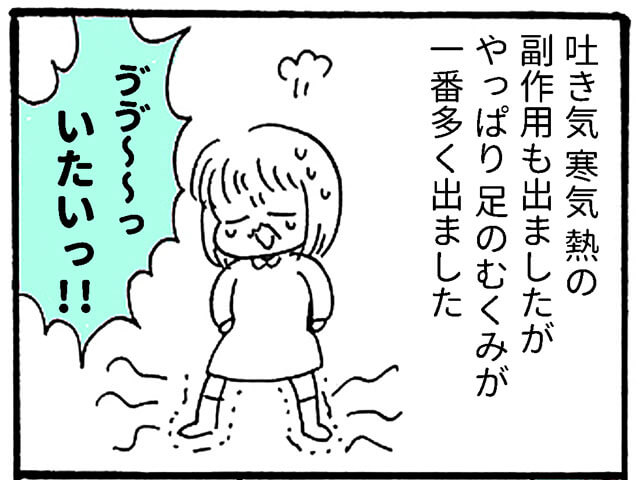 足がむくんでる！　まさか、血栓症？